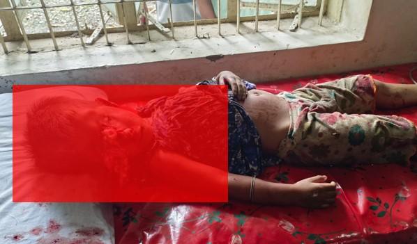 রোয়াংছড়িতে ড্রাম ট্রাকের চাকায় পিষ্ট হয়ে ৪ বছরের শিশু রিমিতার মর্মান্তিক মৃত্যু; চালক আটক
